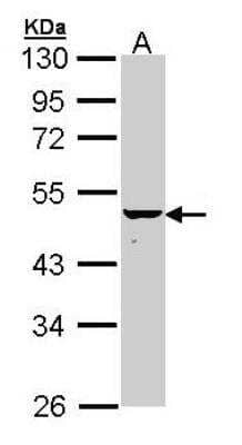 Western Blot KRT34 Antibody