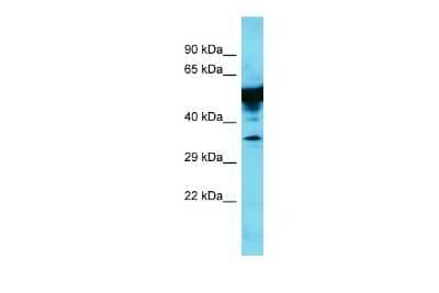 Western Blot: KRT35 Antibody [NBP2-84122] - Host: Rabbit. Target Name: Krt35. Sample Type: Rat Lung lysates. Antibody Dilution: 1.0ug/ml