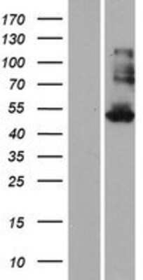 Western Blot: KRT35 Overexpression Lysate (Adult Normal) [NBP2-08131] Left-Empty vector transfected control cell lysate (HEK293 cell lysate); Right -Over-expression Lysate for KRT35.