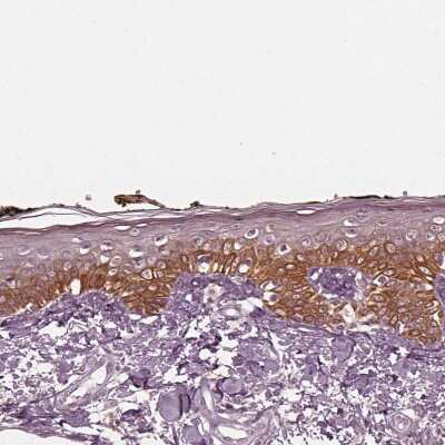 Immunohistochemistry-Paraffin: KRT6L Antibody [NBP2-31764] - Staining of human skin shows moderate cytoplasmic positivity in squamous epithelial cells.