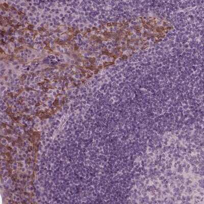 Immunohistochemistry-Paraffin: KRT6L Antibody [NBP2-31764] - Staining of human tonsil shows moderate cytoplasmic positivity in squamous epithelial cells.