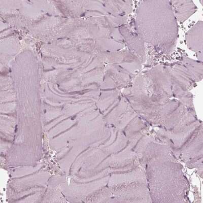 Immunohistochemistry-Paraffin: KRT6L Antibody [NBP2-31764] - Staining of human skeletal muscle shows no positivity in myocytes as expected.