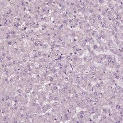 Immunohistochemistry-Paraffin: KRT6L Antibody [NBP2-31764] - Staining of human liver shows no positivity in hepatocytes as expected.