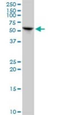 Western Blot: KRT6L Antibody [H00338785-B01P] - Analysis of KRT79 expression in HeLa.