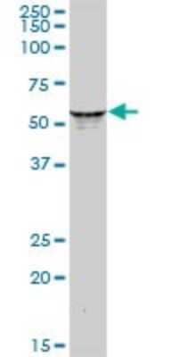 Western Blot: KRT6L Antibody [H00338785-B01P] - Analysis of KRT6L expression in human pancreas.