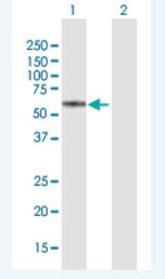 Western Blot KRT74 Antibody - Azide and BSA Free