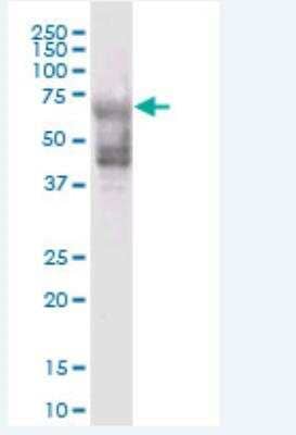 Western Blot KRT74 Antibody - Azide and BSA Free