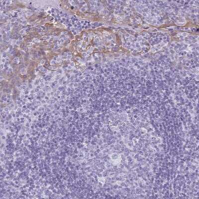 Immunohistochemistry-Paraffin: KRT78 Antibody [NBP1-93671] - Staining of human tonsil shows weak to moderate cytoplasmic positivity in squamous epithelial cells.