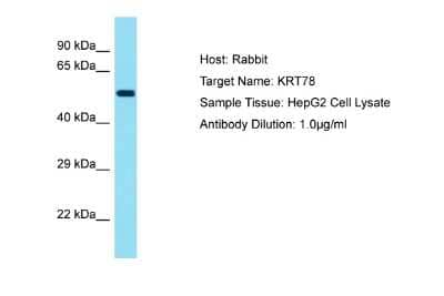 Western Blot: KRT78 Antibody [NBP2-83130] - Host: Rabbit. Target Name: KRT78. Sample Tissue: Human HepG2 Whole Cell. Antibody Dilution: 1ug/ml
