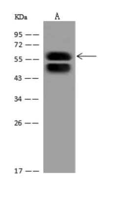 Western Blot: KRT78 Antibody [NBP3-06028] - Anti-KRT78 rabbit polyclonal antibody at 1:500 dilution Lane A: Hela Whole Cell Lysate Lysates/proteins at 30 ug per lane. Secondary: Goat Anti-Rabbit IgG (H+L)HRP  at 110000 dilution. Developed using the ECL technique. Performed under reducing conditions.Predicted band size:56 kDa Observed band size:56 kDa (We are unsure as to the identity of these extra bands.)
