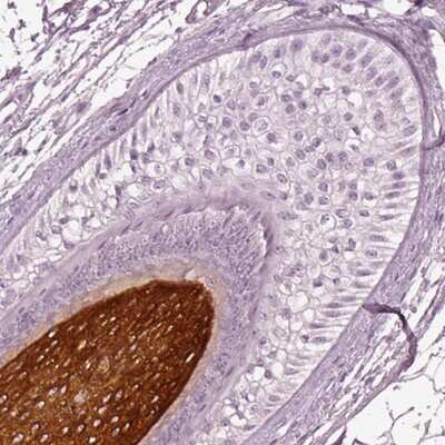 Immunohistochemistry-Paraffin: KRT81 Antibody [NBP2-57133] - Staining of human hair shows strong cytoplasmic positivity in cells in cortex/medulla.