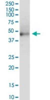 Western Blot KRT81 Antibody - Azide and BSA Free