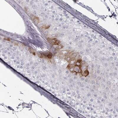 Immunohistochemistry-Paraffin KRT84 Antibody - BSA Free