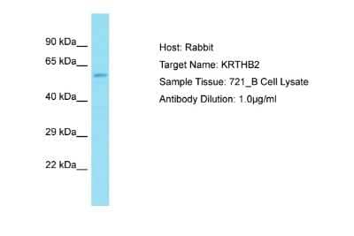 Western Blot: KRT84 Antibody [NBP2-85174] - Host: Rabbit. Target Name: KRT84. Sample Tissue: Human 721_B Whole Cell. Antibody Dilution: 1ug/ml