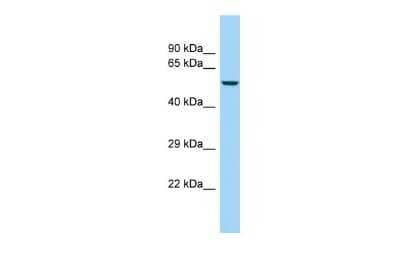 Western Blot: KRT85 Antibody [NBP2-84123] - WB Suggested Anti-KRT85 Antibody. Titration: 1.0 ug/ml. Positive Control: OVCAR-3 Whole CellKRT85 is supported by BioGPS gene expression data to be expressed in OVCAR3