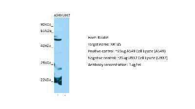 Western Blot: KRT85 Antibody [NBP2-84123] - Host: Rabbit. Target: KRT85. Positive control (+): A549 Cell Lysate (N03). Negative control (-): U937 Cell Lysate (N31). Antibody concentration: 1ug/ml