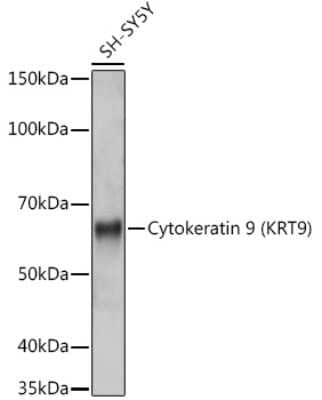 Western Blot: KRT9 Antibody (9A5H3) [NBP3-16841] - Western blot analysis of extracts of SH-SY5Y cells, using KRT9 (KRT9) antibody (NBP3-16841) at 1:1000 dilution. Secondary antibody: HRP Goat Anti-Rabbit IgG (H+L) at 1:10000 dilution. Lysates/proteins: 25ug per lane. Blocking buffer: 3% nonfat dry milk in TBST. Detection: ECL Basic Kit. Exposure time: 1s.