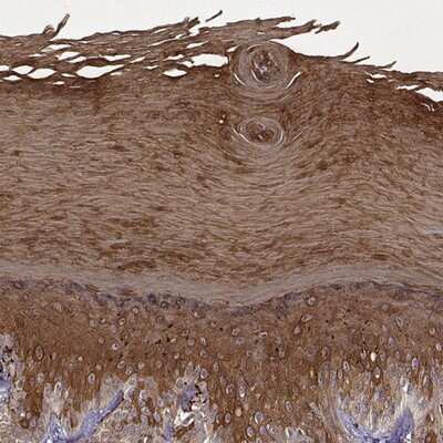 Immunohistochemistry-Paraffin: KRT9 Antibody [NBP1-94099] - Staining of human sole of foot shows strong cytoplasmic positivity in the epidermal cells.