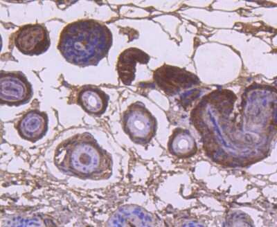 Immunohistochemistry-Paraffin: KRT9 Antibody (SD201-09) [NBP2-67810] - Analysis of mouse skin tissue using anti-Cytokeratin 9 antibody. Counter stained with hematoxylin.