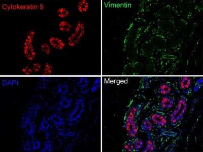 Immunohistochemistry-Paraffin: KRT9 Antibody (SD201-09) [NBP2-67810] - Immunofluorescence analysis of paraffin-embedded human breast tissue labeling KRT9 washed with PBS. And then probed with the primary antibodies KRT9 (red) at 1/50 dilution and Vimentin (green) at 1/500 dilution at +4 overnight, washed with PBS. Goat Anti-Rabbit IgG H&L (iFluor(TM) 594) and Goat Anti-Mouse IgG H&L (iFluor(TM) 488) were used as the secondary antibodies at 1/1,000 dilution. Nuclei were counterstained with DAPI (blue).