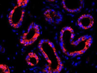 Immunohistochemistry-Paraffin: KRT9 Antibody (SD201-09) [NBP2-67810] - Immunofluorescence analysis of paraffin-embedded human breast tissue labeling KRT9 (washed with PBS. And then probed with the primary antibodies KRT9 (red) at 1/50 dilution at +4 overnight, washed with PBS. Goat Anti-Rabbit IgG H&L (iFluor(TM) 594) was used as the secondary antibodies at 1/1,000 dilution. Nuclei were counterstained with DAPI (blue).