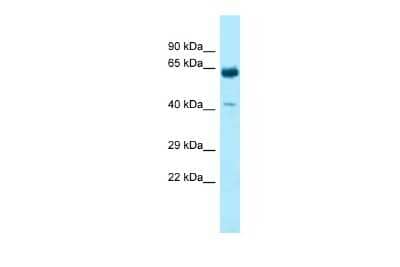 Western Blot: KRT9 Antibody [NBP2-85176] - WB Suggested Anti-KRT9 Antibody. Titration: 1.0 ug/ml. Positive Control: Fetal Heart