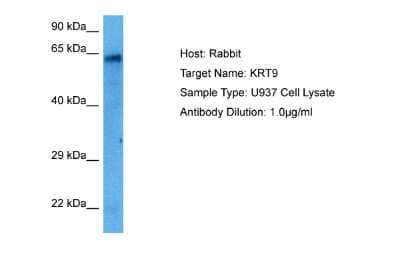 Western Blot: KRT9 Antibody [NBP2-85177] - Host: Rabbit. Target Name: KRT9. Sample Tissue: Human U937 Whole Cell lysates. Antibody Dilution: 1ug/ml