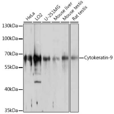 Western Blot: KRT9 Antibody [NBP3-04736] - Analysis of extracts of various cell lines, using KRT9 antibody at 1:1000 dilution. Secondary antibody: HRP Goat Anti-Rabbit IgG (H+L) at 1:10000 dilution. Lysates/proteins: 25ug per lane. Blocking buffer: 3% nonfat dry milk in TBST. Detection: ECL Basic Kit