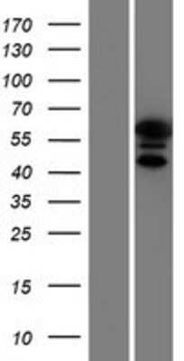 Western Blot: KRT9 Overexpression Lysate (Adult Normal) [NBP2-09046] Left-Empty vector transfected control cell lysate (HEK293 cell lysate); Right -Over-expression Lysate for KRT9.