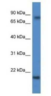 Western Blot: KRTAP1-5 Antibody [NBP1-79847] - Human Fetal Brain Lysate, concentration 1 ug/ml.