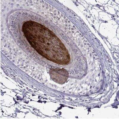 Immunohistochemistry-Paraffin: KRTAP11-1 Antibody [NBP2-55564] - Staining of human skin shows moderate to strong cytoplasmic positivity in hair follicle.