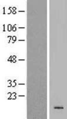 Western Blot: KRTAP19-4 Overexpression Lysate (Adult Normal) [NBP2-04916] Left-Empty vector transfected control cell lysate (HEK293 cell lysate); Right -Over-expression Lysate for KRTAP19-4.