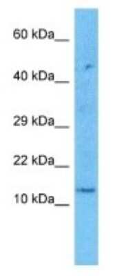 Western Blot: KRTAP2-1 Antibody [NBP3-09400] - Western blot analysis of KRTAP2-1 in 786-0 Whole Cell lysates. Antibody dilution at 1.0ug/ml