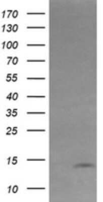 Western Blot: KRTAP2-4 Antibody (OTI3B4) - Azide and BSA Free [NBP2-72304] - Analysis of HEK293T cells were transfected with the pCMV6-ENTRY control (Left lane) or pCMV6-ENTRY KRTAP2-4.