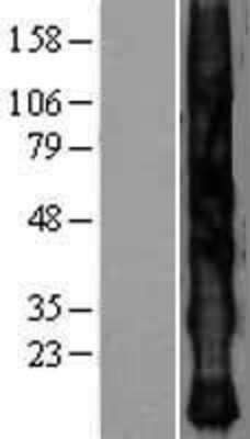 Western Blot: KRTAP2-4 Overexpression Lysate (Adult Normal) [NBL1-12405] Left-Empty vector transfected control cell lysate (HEK293 cell lysate); Right -Over-expression Lysate for KRTAP2-4.