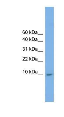 Western Blot: KRTAP23-1 Antibody [NBP1-70596] - HepG2 cell lysate, concentration 0.2-1 ug/ml.