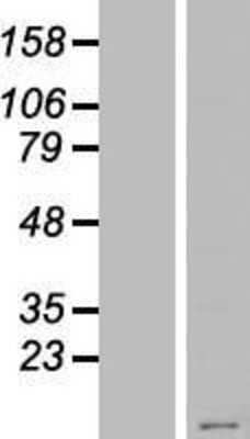 Western Blot: KRTAP23-1 Overexpression Lysate (Adult Normal) [NBP2-04917] Left-Empty vector transfected control cell lysate (HEK293 cell lysate); Right -Over-expression Lysate for KRTAP23-1.