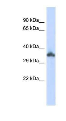 Western Blot: KRTAP24-1 Antibody [NBP1-91600] - Titration: 0.2-1 ug/ml, Positive Control: 293T cell lysate.