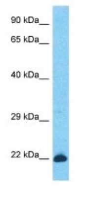 Western Blot: KRTAP26-1 Antibody [NBP3-09226] - Western blot analysis of KRTAP26-1 in HT1080 Whole Cell lysates. Antibody dilution at 1.0ug/ml