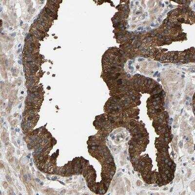 Immunohistochemistry: KRTAP27-1 Antibody [NBP1-91071] - Staining of human prostate shows strong cytoplasmic positivity in glandular cells.