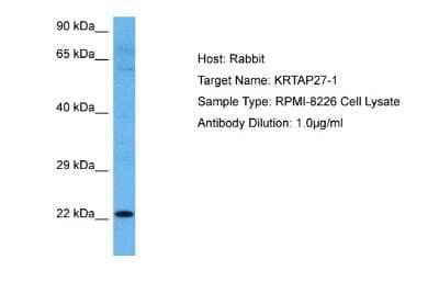 Western Blot: KRTAP27-1 Antibody [NBP2-85178] - Host: Rabbit. Target Name: KRTAP27-1. Sample Tissue: Human RPMI 8226 Whole Cell lysates. Antibody Dilution: 1ug/ml