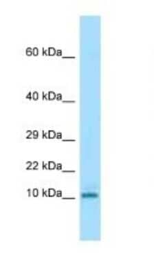Western Blot: KRTAP3-3 Antibody [NBP1-98505] - Titration: 1.0 ug/ml Positive Control: Mouse Spleen.