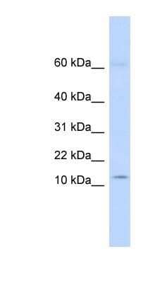 Western Blot KRTAP8-1 Antibody