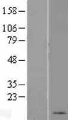 Western Blot: KRTAP8-1 Overexpression Lysate (Adult Normal) [NBP2-05053] Left-Empty vector transfected control cell lysate (HEK293 cell lysate); Right -Over-expression Lysate for KRTAP8-1.