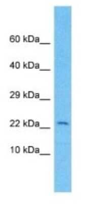 Western Blot: KRTAP9-2 Antibody [NBP3-09397] - Western blot analysis of KRTAP9-2 in MCF7 Whole Cell lysates. Antibody dilution at 1.0ug/ml