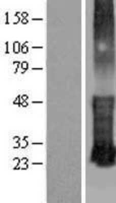 Western Blot: KRTCAP3 Overexpression Lysate (Adult Normal) [NBL1-12412] Left-Empty vector transfected control cell lysate (HEK293 cell lysate); Right -Over-expression Lysate for KRTCAP3.