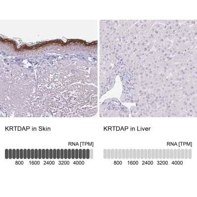 Immunohistochemistry-Paraffin KRTDAP Antibody