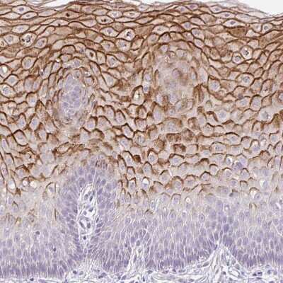 Immunohistochemistry-Paraffin KRTDAP Antibody