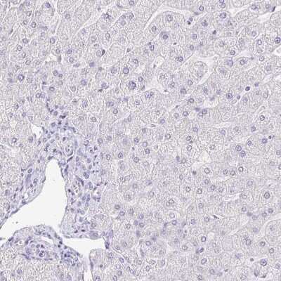 Immunohistochemistry-Paraffin KRTDAP Antibody