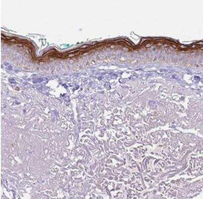 Immunohistochemistry-Paraffin: KRTDAP Antibody [NBP2-38029] - Staining of human skin shows strong cytoplasmic and membranous positivity in keratonocytes.